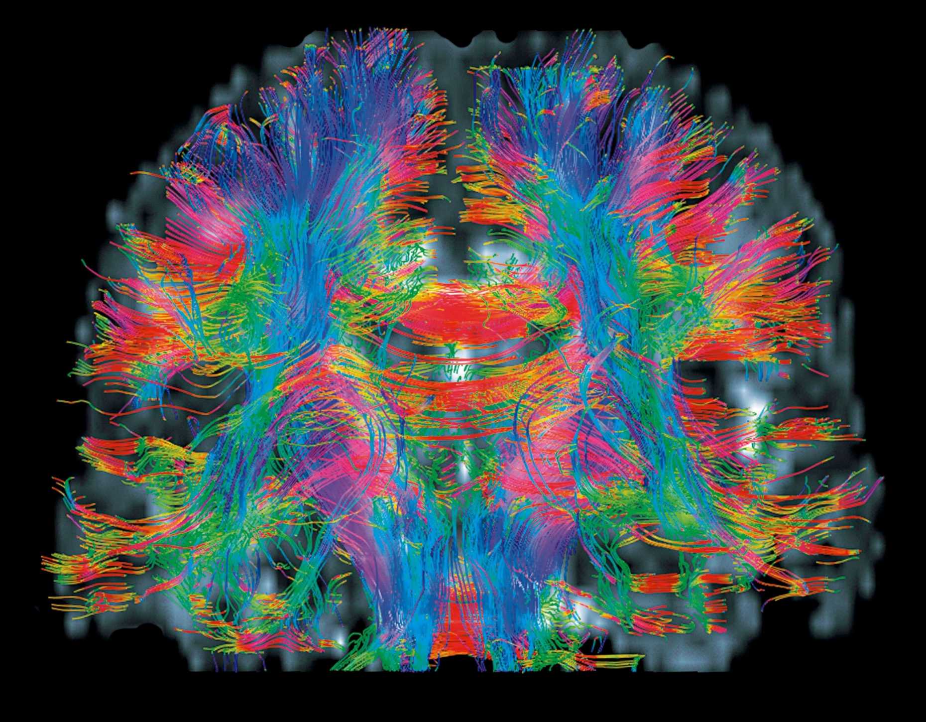 A magnetic resonance imaging scan of the human brain. Credit:&nbsp; ETH Zurich / Prof Peter Bösiger